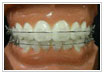 sec3_image