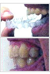sec5_image